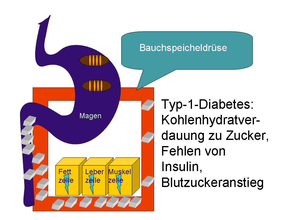 Was ist Diabetes mellitus | Deutsche Diabetes Föderation